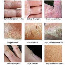 Afbeelding in Gallery-weergave laden, Anti-kraak wintercrème