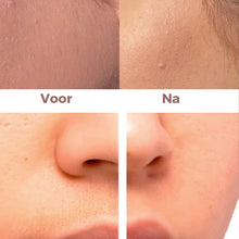 Afbeelding in Gallery-weergave laden, Gezichts-epilator