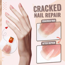 Afbeelding in Gallery-weergave laden, Reparatielijm voor nagelvezels