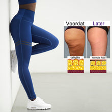Afbeelding in Gallery-weergave laden, Compressielegging tegen cellulitis voor dames