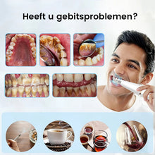 Afbeelding in Gallery-weergave laden, Ultrasone tandenreiniger