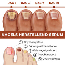 Afbeelding in Gallery-weergave laden, 7 dagen nagelgroei en versterkend serum