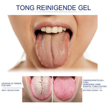 Afbeelding in Gallery-weergave laden, Tong reinigingsgel set