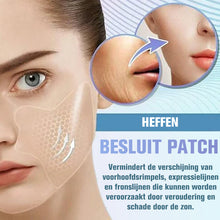 Afbeelding in Gallery-weergave laden, Rimpelverwijderaars Patches