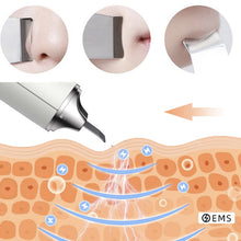 Afbeelding in Gallery-weergave laden, Mini Ultrasonic 2 in 1 Multi-Functional Skin Vacuum