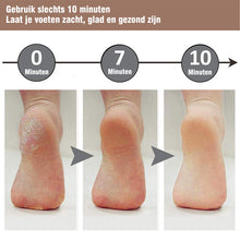 Afbeelding in Gallery-weergave laden, Pedicure Voet Bestand