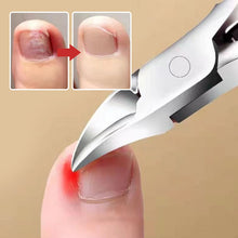 Afbeelding in Gallery-weergave laden, Roestvrijstalen nagelgroef olecranon clipper