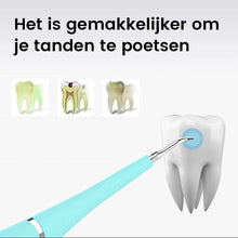 Afbeelding in Gallery-weergave laden, Ultrasone tandenreiniger
