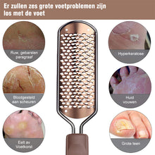 Afbeelding in Gallery-weergave laden, Pedicure  Voet Bestand
