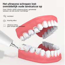 Afbeelding in Gallery-weergave laden, Sonic elektrische tandheelkundige scaler

