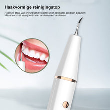 Afbeelding in Gallery-weergave laden, Sonic elektrische tandheelkundige scaler
