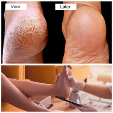 Afbeelding in Gallery-weergave laden, Pedicure  Voet Bestand
