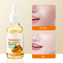 Afbeelding in Gallery-weergave laden, Kurkuma anti-oxidatie serum
