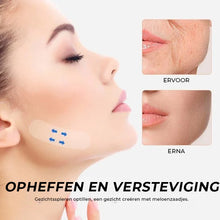 Afbeelding in Gallery-weergave laden, Onzichtbare Face Lifter-tape
