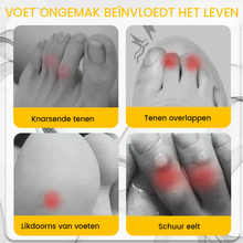 Afbeelding in Gallery-weergave laden, Siliconen anti-wrijving teenbeschermer
