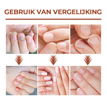 Afbeelding in Gallery-weergave laden, 7 dagen nagelgroei en versterkend serum
